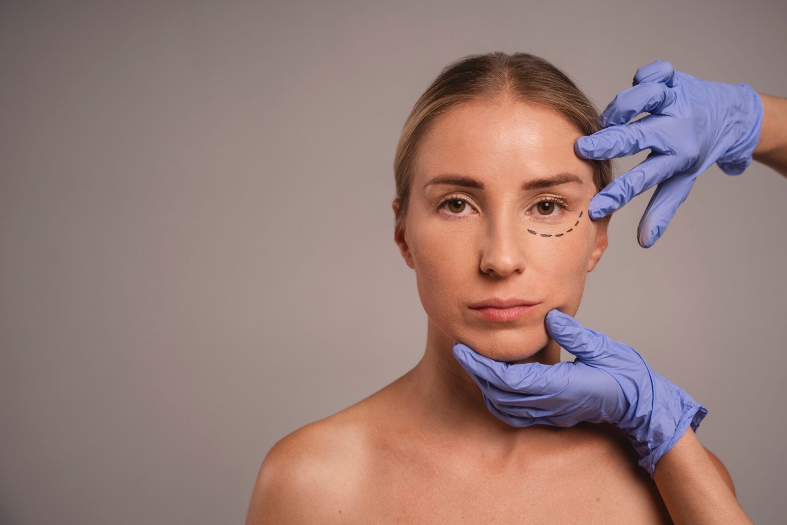 face lift with threads